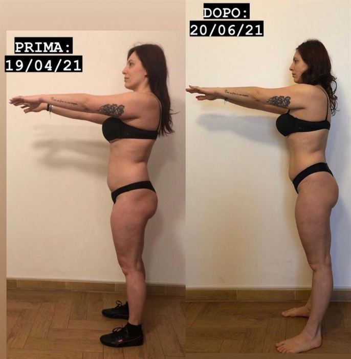 foto prima dopo lato
