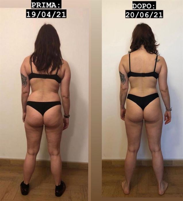 foto prima dopo dietro