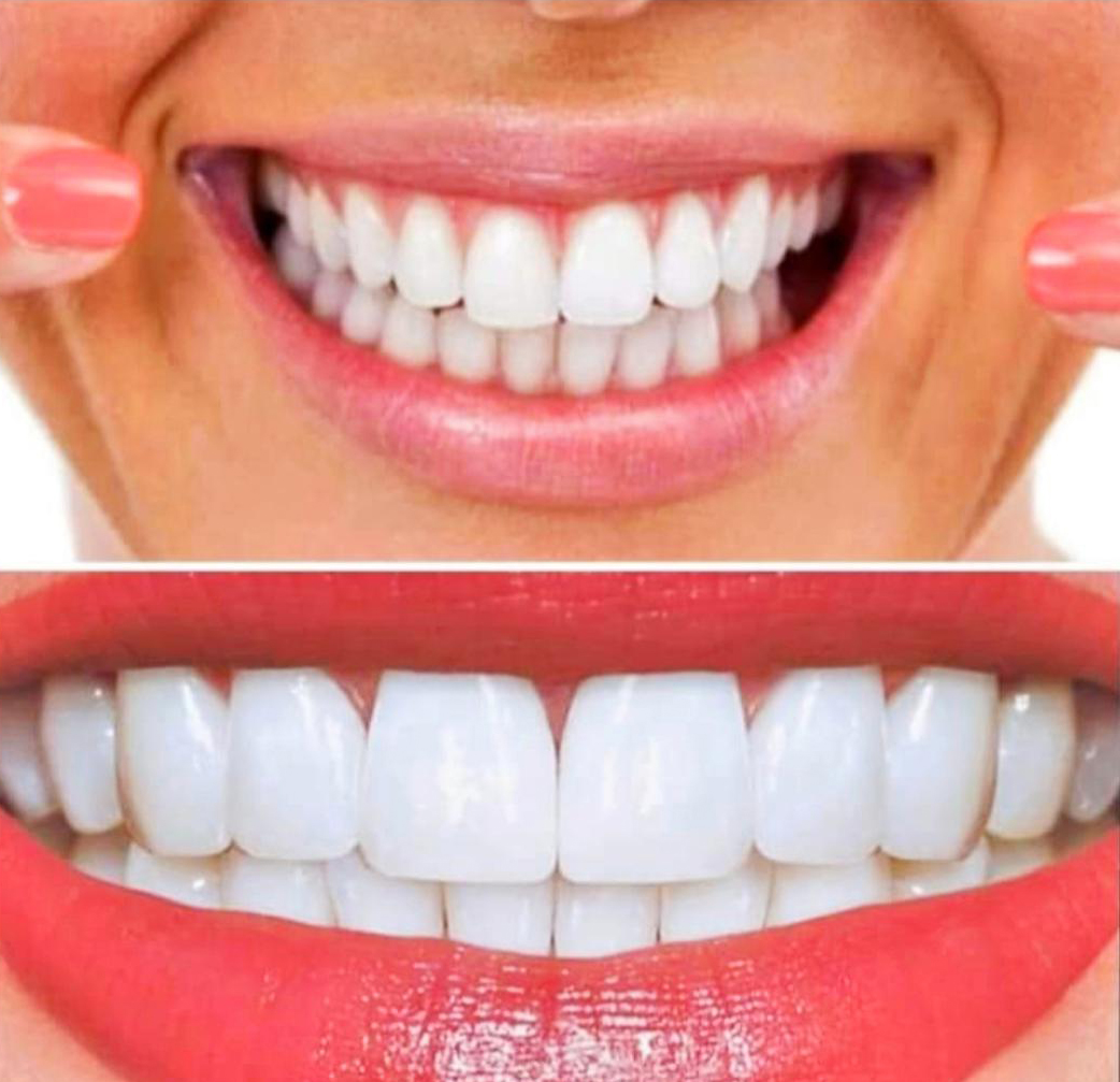 immagine denti