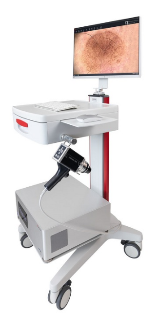 Immagine Videodermatoscopio
