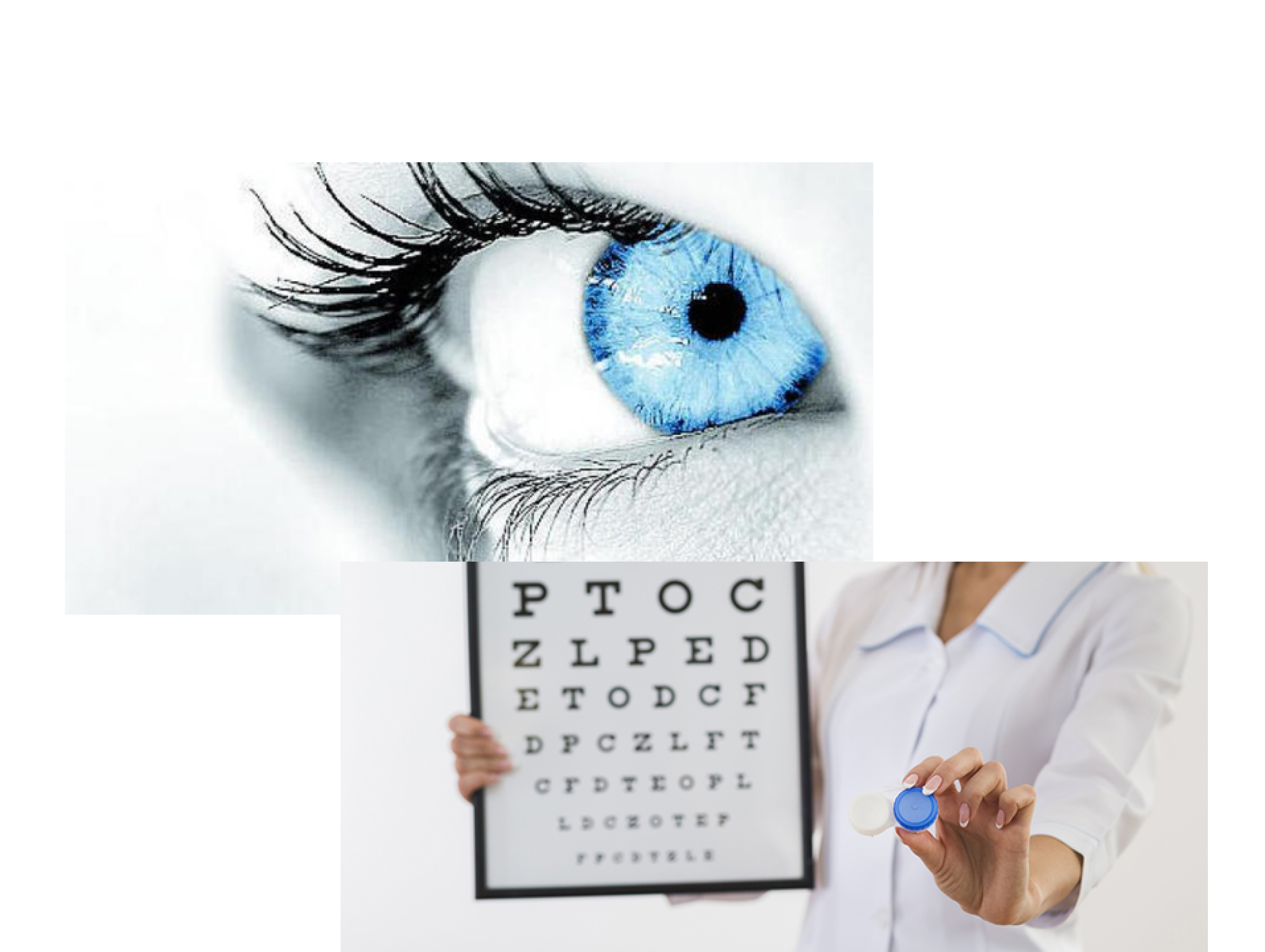 oculista