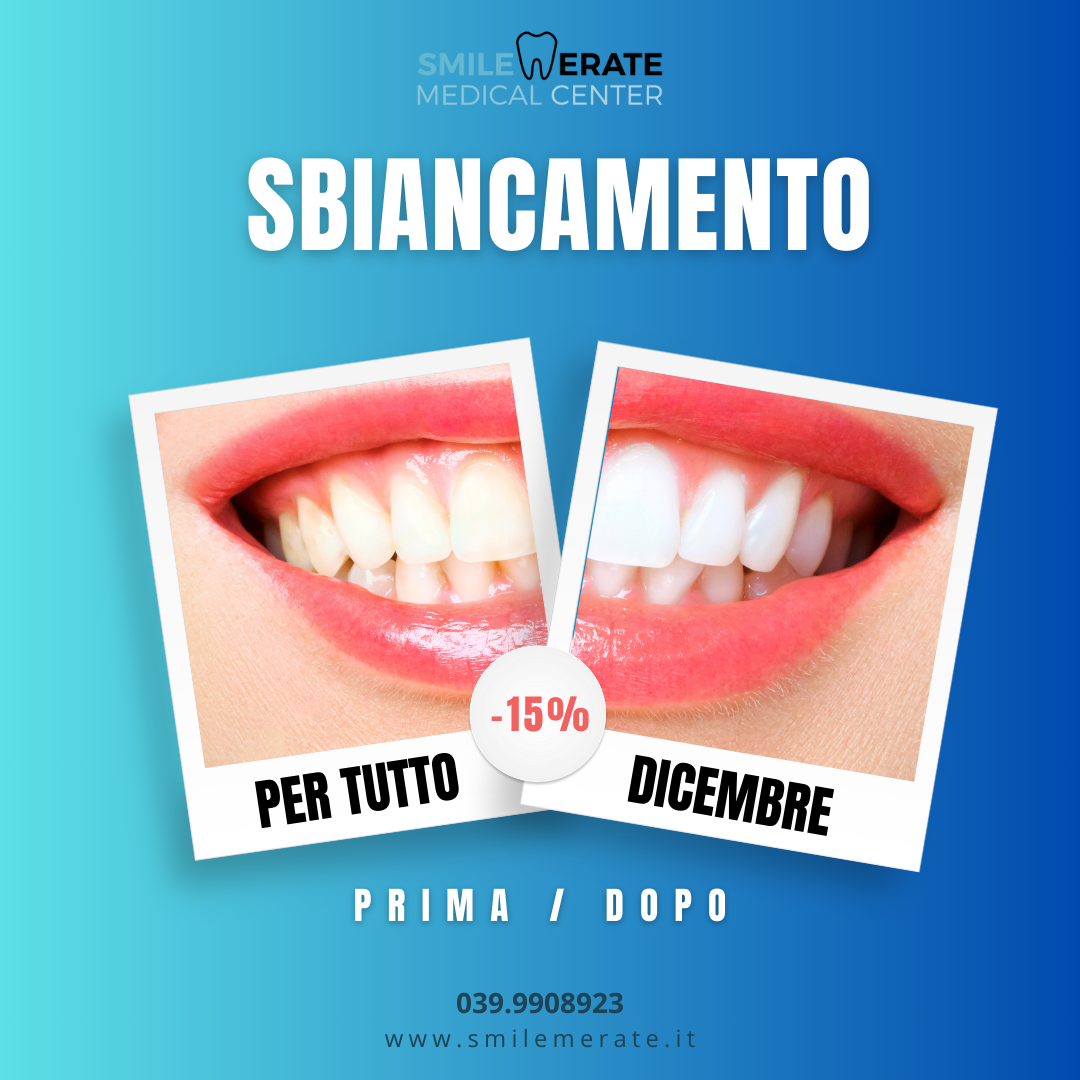 Immagine promo sbiancamento Smile Merate Medical Center