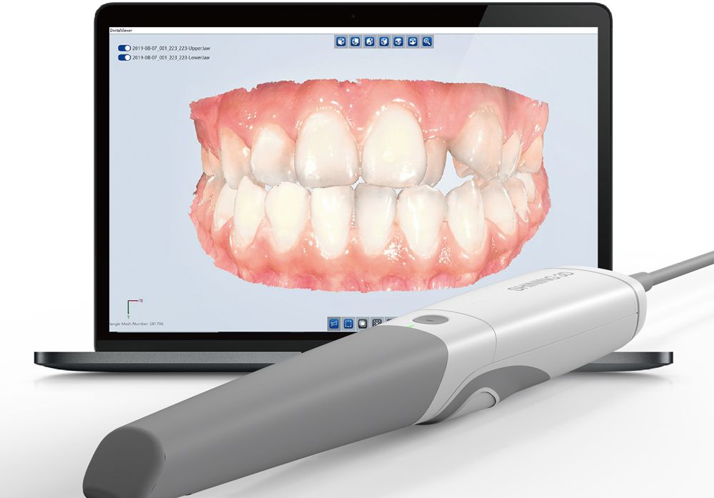 impronta digitale dentale