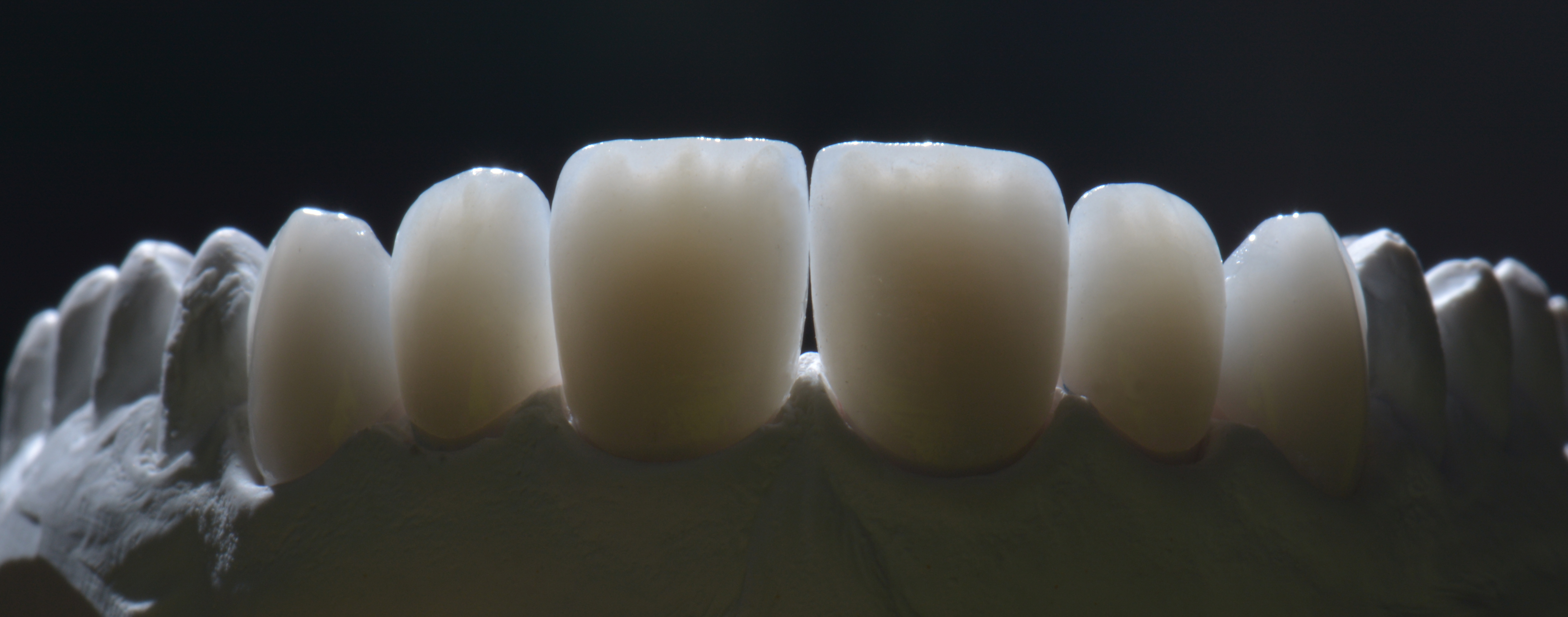 ceramica integrale faccette