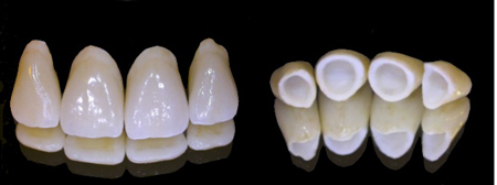 corone in ceramica