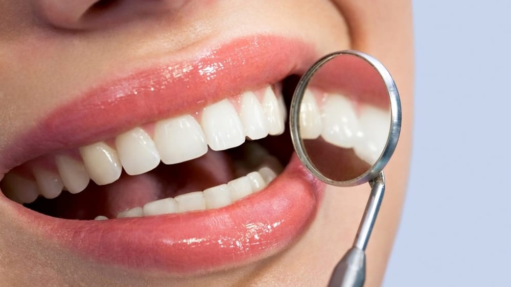 sorriso denti bianchi