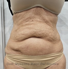 Dr. Massimo Macrì Del Giudice – Medico Chirurgo, Medicina estetica