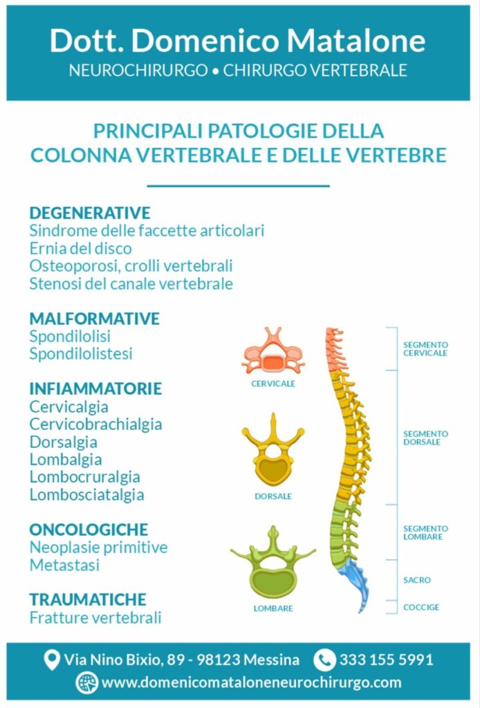 Dott. Domenico Matalone – Neurochirurgo e Chirurgo Vertebrale (Messina)