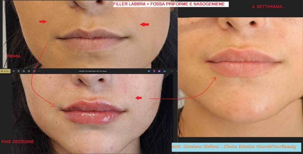 Nourish Your Beauty