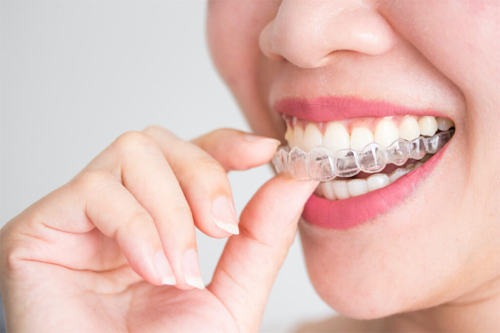 Studio Dentistico Chisone – Studio Dentistico Leoci – Studio dentistico Pellegrino